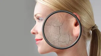 أسباب جفاف الجسم