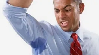 أسباب كثرة التعرق