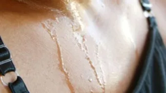 أسباب التعرق الزائد