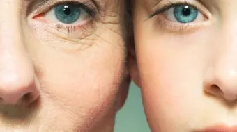 أسباب ترهل الوجه