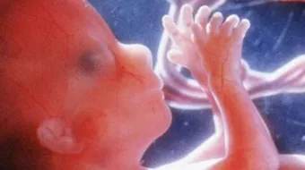 أسباب ضعف دقات قلب الجنين