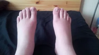 أسباب احتباس السوائل في الجسم