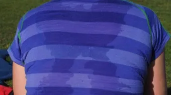 أسباب فرط التعرق