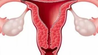 أسباب زيادة سمك بطانة الرحم