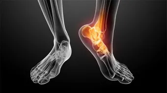 أسباب آلام المفاصل والعظام