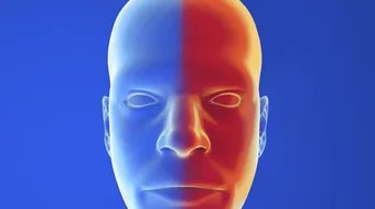 أسباب الصداع النصفي الأيسر