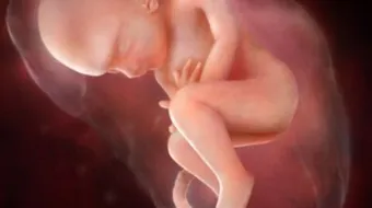 أسباب ضعف نمو الجنين