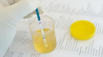 أسباب ضعف دفع البول