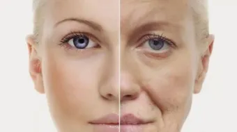 أسباب الشيخوخة المبكرة