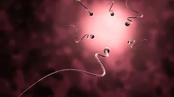 اسباب تشوهات الحيوان المنوى