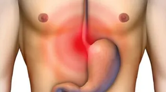 أسباب ألم المعدة