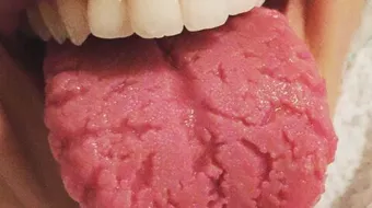 أسباب تشققات اللسان