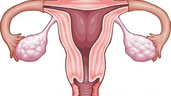 أسباب نزيف الرحم