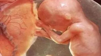 أسباب ضعف نبض الجنين في الشهر الرابع