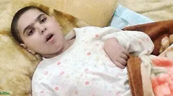 ضمور المخيخ عند الأطفال