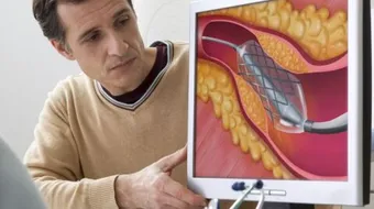 أضرار الكولسترول وعلاجه