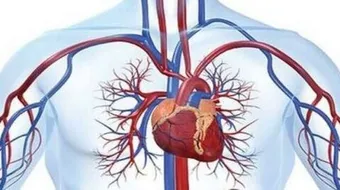 اضطراب الدورة الدموية