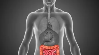 مرض القولون