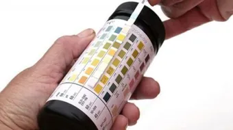 تحليل البول الكامل