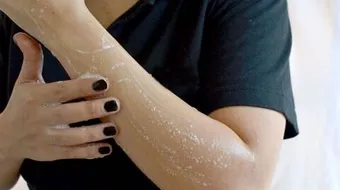 التخلص من الشعر نهائياً