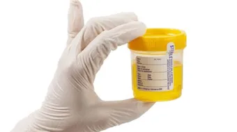 مضاعفات مرض الزلال