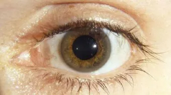 دورة النحاس ومرض ويلسون