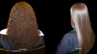 أضرار الكرياتين