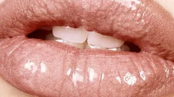 أضرار نفخ الشفاه