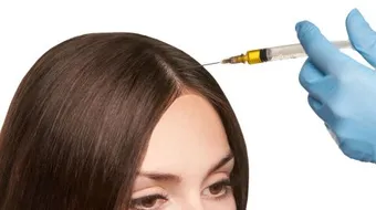 أضرار حقن البلازما للشعر