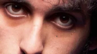 سواد تحت العين