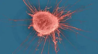 تعريف السرطان