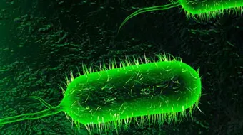 تعريف داء الكوليرا