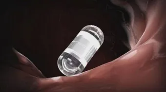 تعريف أطفال الأنابيب