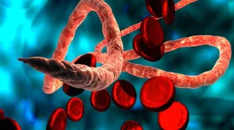 تشخيص ألفا ثلاسيميا