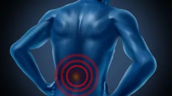 تشخيص ضعف وضمور العضلات