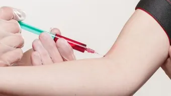 تحليل هرمون الحمل الرقمي