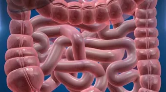 هل القولون يسبب حالة نفسية