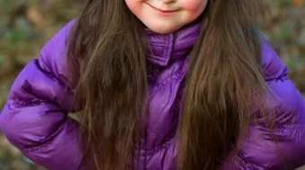 علاج مرض داون