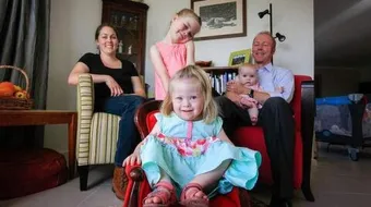 أعراض مرض داون