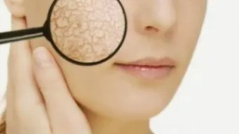 وصفات للوجه الجاف