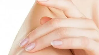 آثار الجروح القديمة