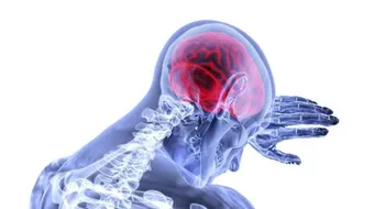 آثار جلطة المخ