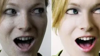 التخلص من الكلف