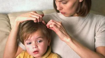 القضاء على القمل بالأعشاب