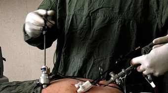 جراحة المنظار