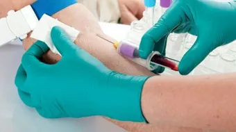 فحص وظائف الكلية