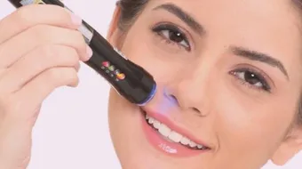 إزالة شعر الوجه