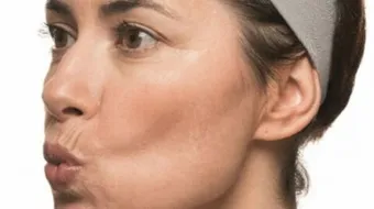 تمرين عضلات الوجه