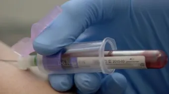 تحليل الدهون