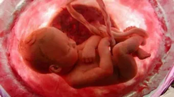 عوامل سقوط الجنین